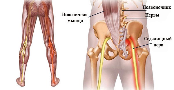 Обратите внимание на то, что из себя представляет седалищный нерв