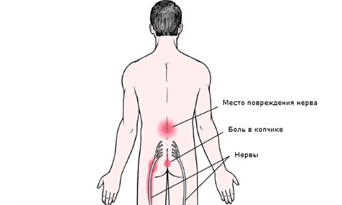 Средство хорошо справляется с поясничными болями