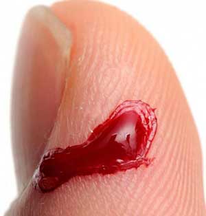 капля крови на пальце