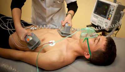 кардиоверсия