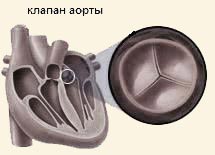 клапан аорты