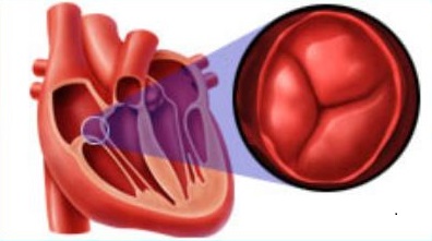 клапан сердца