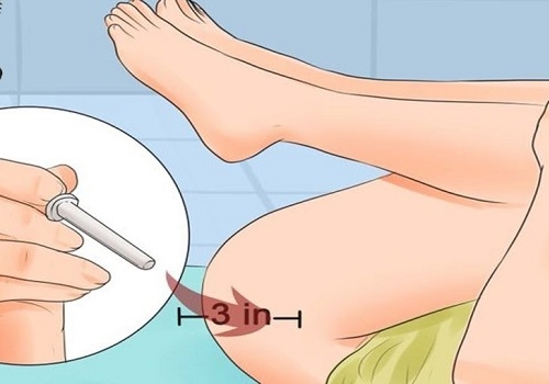 Постановка клизмы ребенку