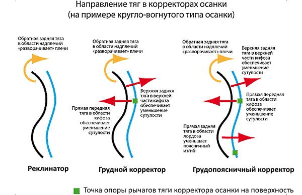 Корсеты создают точки опоры и рычаги, которые выравнивают позвоночный столб