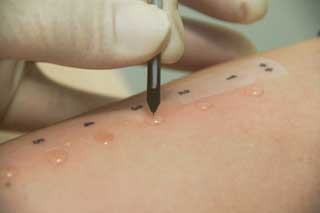 кожные пробы