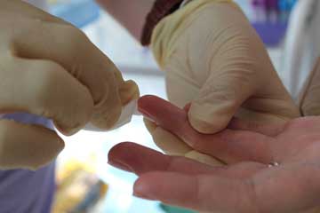 кровь из пальца