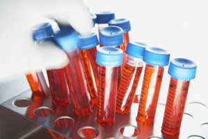 кровь в пробирке