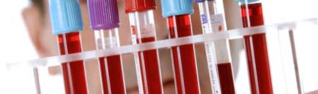 кровь в пробирке
