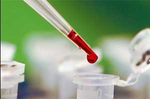 кровь в пробирке