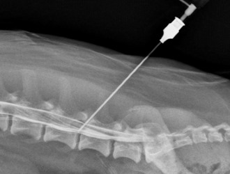 Обратите внимание на методы диагностики спондилеза