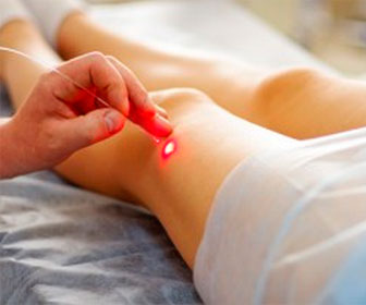 сканирование вен