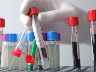 Катадолон может вызывать ложноположительные реакции некоторых тестов