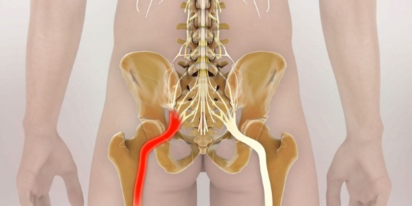 Люмбалгия позвоночника и люмбаго - два разных болевых синдрома