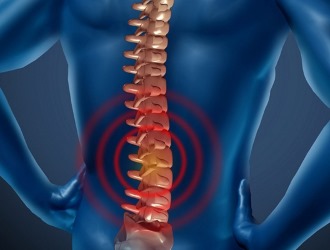 Симптомы хондроза схожи с признаками остеохондроза