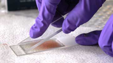 мазок крови