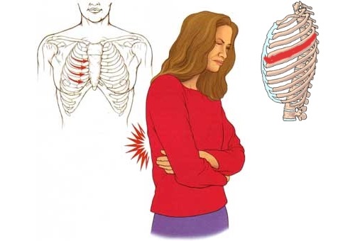Обратите на локализацию боли при невралгии у беременных