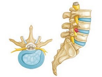 Обратите внимание на технику проведения мануальной терапии при поясничной грыже
