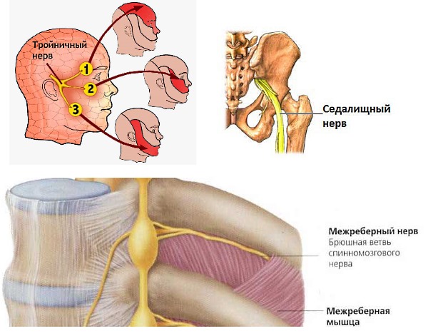 Назначается Пенталгин ICN при невралгии и других типах боли