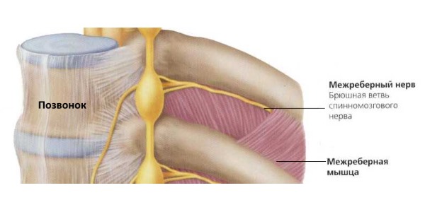Межреберная невралгия возникает при ущемлении межреберного нерва