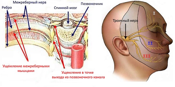 Невралгия бывает разных типов, в зависимости от того, какой нерв был поврежден