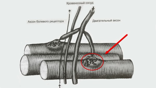 Чаще всего болевые триггерные точки появляются в следствии неврологических нарушений
