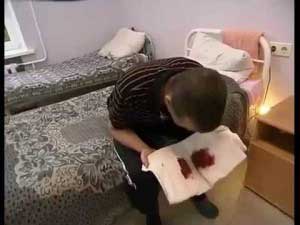 мокрота с кровью