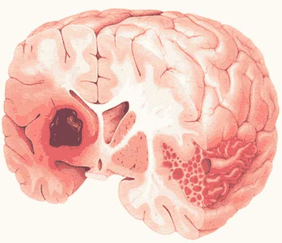 мозг человека
