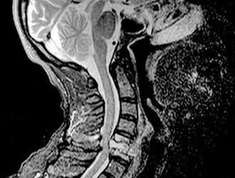 При подозрении на дорсопатию следует обратиться к травматологу или неврологу