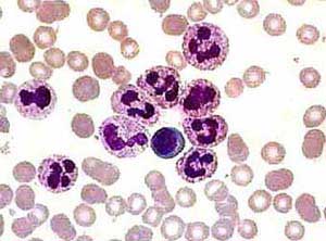 нейтрофилы