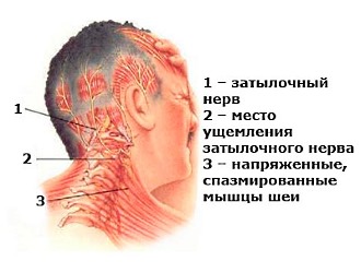 Обратите внимание на основные симптомы защемления нервов в шее