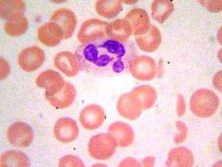 нейтрофилы в крови