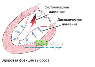 норма выброса крови из сердца