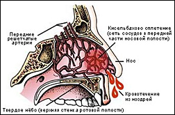 сосуды в носу