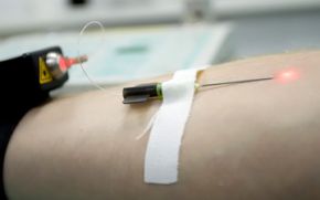 облучение крови