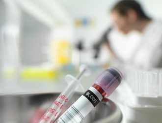 Для диагностики остеопороза могут понадобиться анализы на гормоны