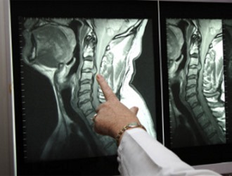 Обратите внимание как проводят диагностику при радикулите