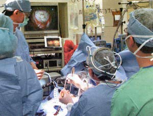 операция на сердце