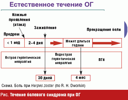 Опоясывающий герпес и герпес-ассоциированная боль 19.08.2021