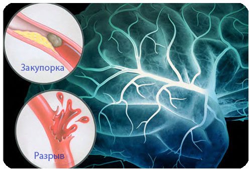 Органическое поражение мозга и другие причины