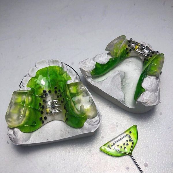 Ортодонтическая пластинка для детей. Классификация и виды, цены