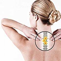 остеохондроз шейного отдела