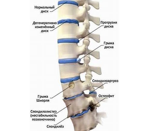 При заболеваниях позвоночника в комплексном лечении обязательно присутствуют упражнения из йоги