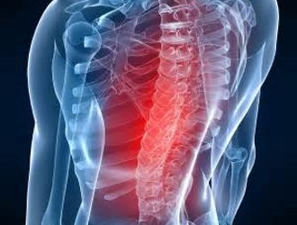 Позвонки начинают смещаться, если имеется какая-либо травма или дефективность