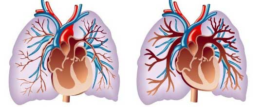 отклонение в развитие сердца