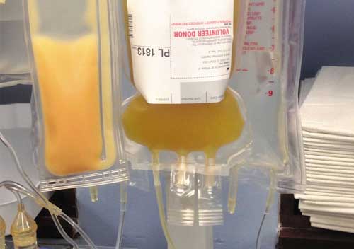 переливание плазмы