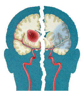 питание мозга кровью