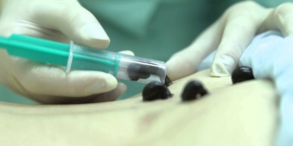 Полезные свойства пиявки обусловлены веществом гирудин, о них более подробно описано ниже