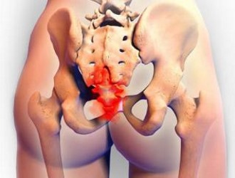 Самый частый симптом кисты в копчике это боль и гнойные выделения