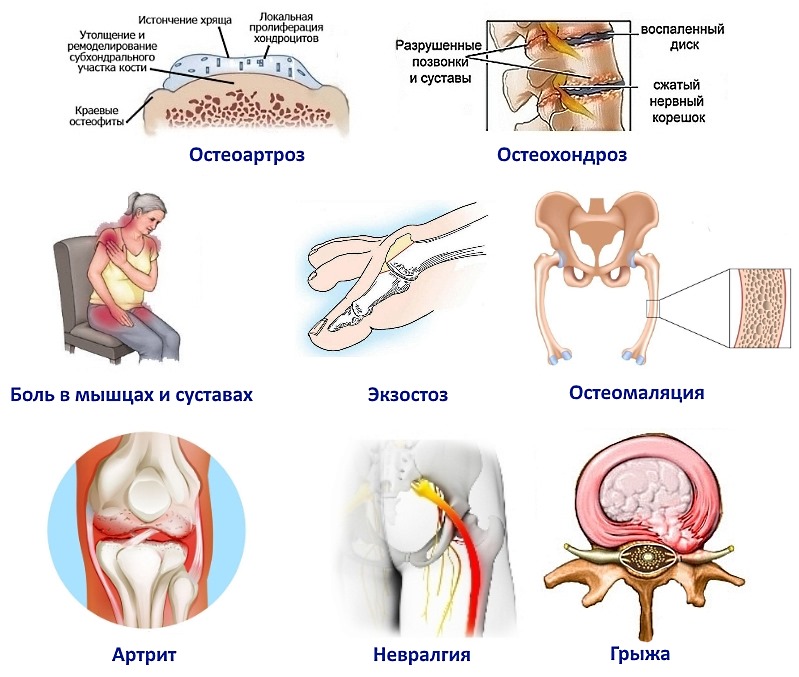 Гомеопатическое средство имеет обширный список показаний