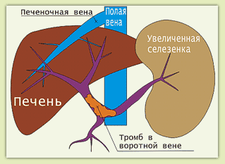 портальная вена
